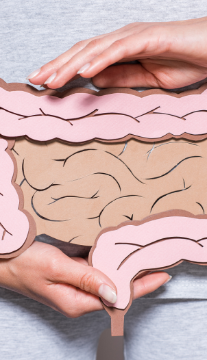 Image representing Irritable Bowel Syndrome (IBS).